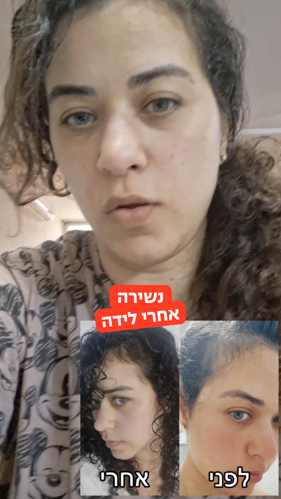 אנט